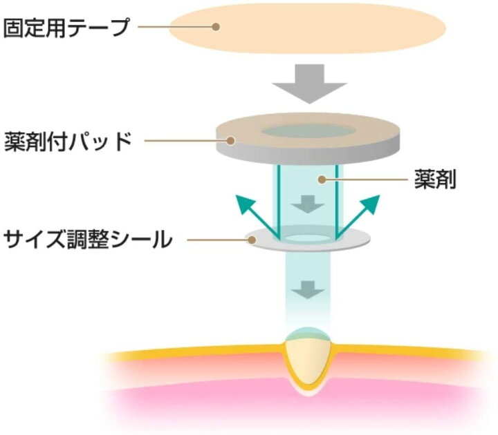 420円 大割引 スピール膏 ワンタッチEXゆび用L 12枚 SPBL 2個セット 第2類医薬品 420円 大割引 スピール膏 ワンタッチEXゆび用L 12枚 SPBL 2個セット 第2類医薬品