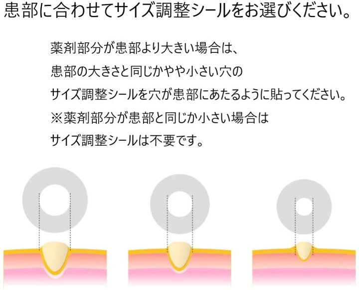 199円 高質で安価 スピールジェル 3g 1個 第2類医薬品 199円 高質で安価 スピールジェル 3g 1個 第2類医薬品