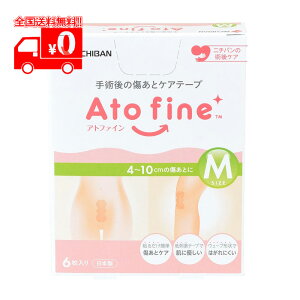 Agt@C Atofine ƃPAe[v MTCY 50mm×114mm (6) (ΉƃTCY 4~10cm) p 鉤؊Jyj`oz