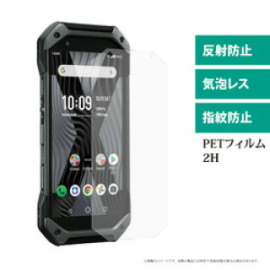 GfB[GX MDS-UGFLKYG01 Z TORQUE 5G KYG01Ή tیtB }bg 񂹏i
