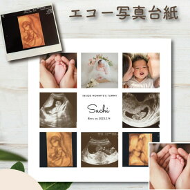【月間優良ショップ受賞店】エコー写真 マタニティアルバム ランキングマタニティ エコー写真保存 赤ちゃん 写真 色褪せない プレゼント 出産 出産祝い ギフト 妊娠 お母さん 赤ちゃん ママ 宝もの プレママ ベビー クリスマス