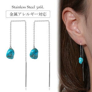 sAX AM[Ή ZJhsAX t@[XgsAX fB[X a v[g XeX316L AJ sAX  `F[ VR a (12) gR[p]