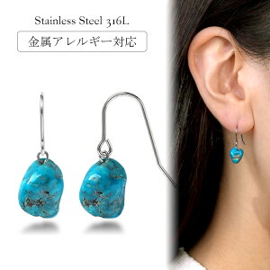 sAX AM[Ή ZJhsAX t@[XgsAX fB[X a v[g XeX316L tbN C[tbN sAX VR a (12) gR[Ўp]