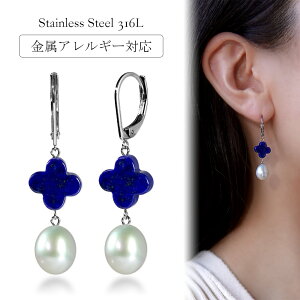 sAX AM[Ή ZJhsAX t@[XgsAX fB[X a v[g XeX316L tbN W[}tbN sAX VR a (12) sXY[[p]