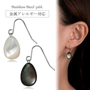 sAX AM[Ή ZJhsAX t@[XgsAX fB[X a v[g XeX316L tbN C[tbN sAX VR L[p]