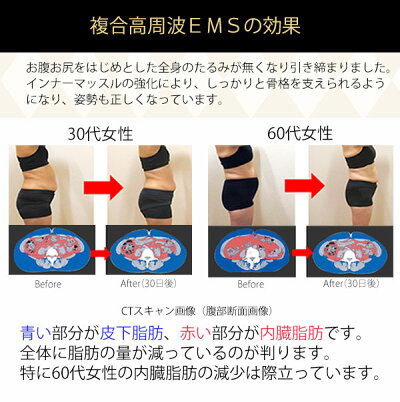 楽天市場 複合高周波ems機器 エクスケアdi 日本製 メーカー保証3年間 インナーマッスル 姿勢 コリ 関節 お腹 骨盤 お尻 ヒップ Ems 腹筋 足 顔 筋力 筋肉 代謝 ダイエット エクササイズ シェイプアップ トレーニング 抱かれ枕の眠り製作所 楽天市場 複合高周波ems機器 エクスケアdi 日本製 メーカー保証3年間 インナーマッスル 姿勢 コリ 関節 お腹 骨盤 お尻 ヒップ Ems 腹筋 足 顔 筋力 筋肉 代謝 ダイエット エクササイズ シェイプアップ トレーニング 抱かれ枕の眠り製作所