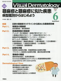 Visual Dermatology 目でみる皮膚科学 Vol.20No.6(2021-6)[本/雑誌] / 福永淳/責任編集