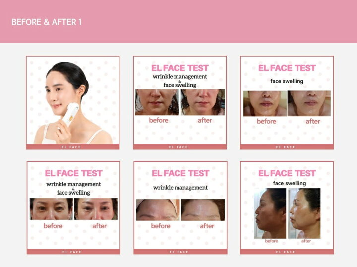 楽天市場】＼ポイント20倍／ エルフェイス ELFACE 美顔器 リフトアップ 
