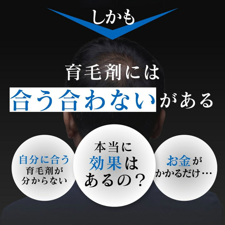 楽天市場】300円OFFクーポン発行中！ 薬用スカルプローション VO-VO 