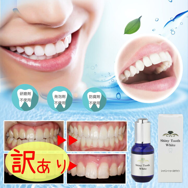 楽天市場】【訳あり 箱潰れ】シャイニートゥースホワイト Shiny Tooth 