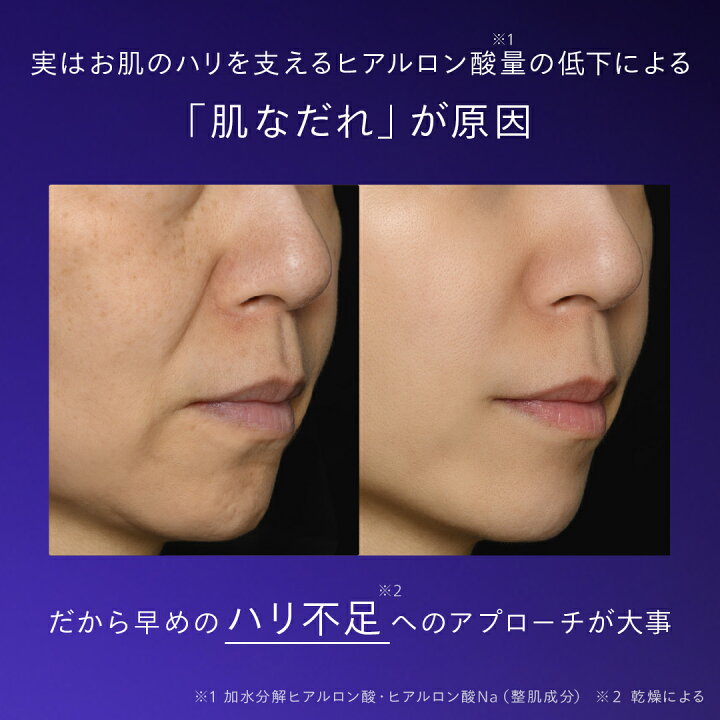 楽天市場】＼クーポン最大1000円OFF／N organic Vie ヒアルアップ 
