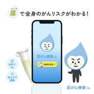 尿がん検査くん 尿がんリスク検査 ステージ1 早期発見 がん リスク 検査 がんリスク 尿検査 尿検査キット…