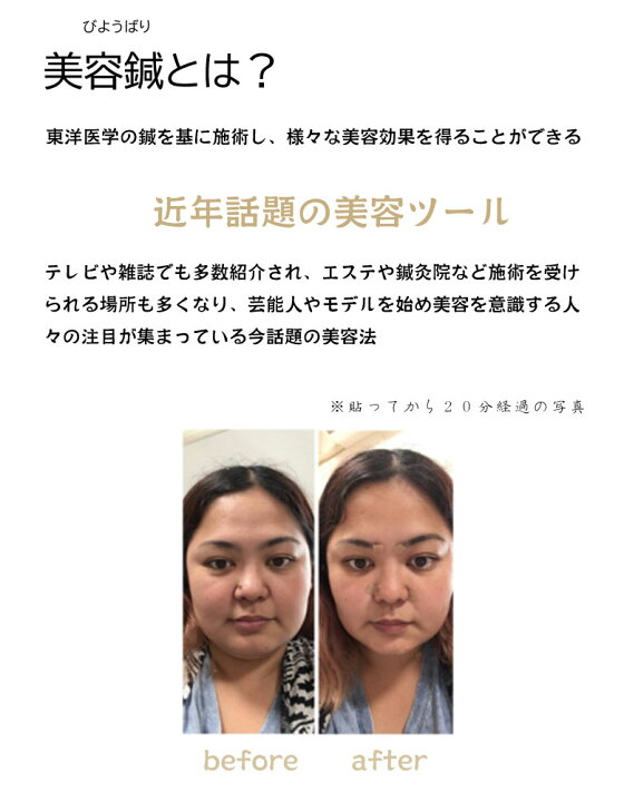 楽天市場 サロン専売品 刺さない美容鍼 Koharich コハリッチ 簡単自宅で分 90粒 30粒 3袋 はり きゅう用器具 一般医療機器 和光電研 日本製 美顔 想いを繋ぐ百貨店 Tsunagu