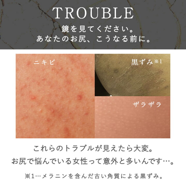 楽天市場 ポイント10倍 お尻 黒ずみ にきび ブツブツ 医薬部外品 薬用 美白クリーム ボディクリーム デリケートゾーン 送料無料 Vio バストトップ 胸 わき 脇 肘 膝 かかと 保湿 マタニティ 毛穴 角質 敏感肌 肌荒れ 乾燥 日本製 オシリスト Oshirist 100g