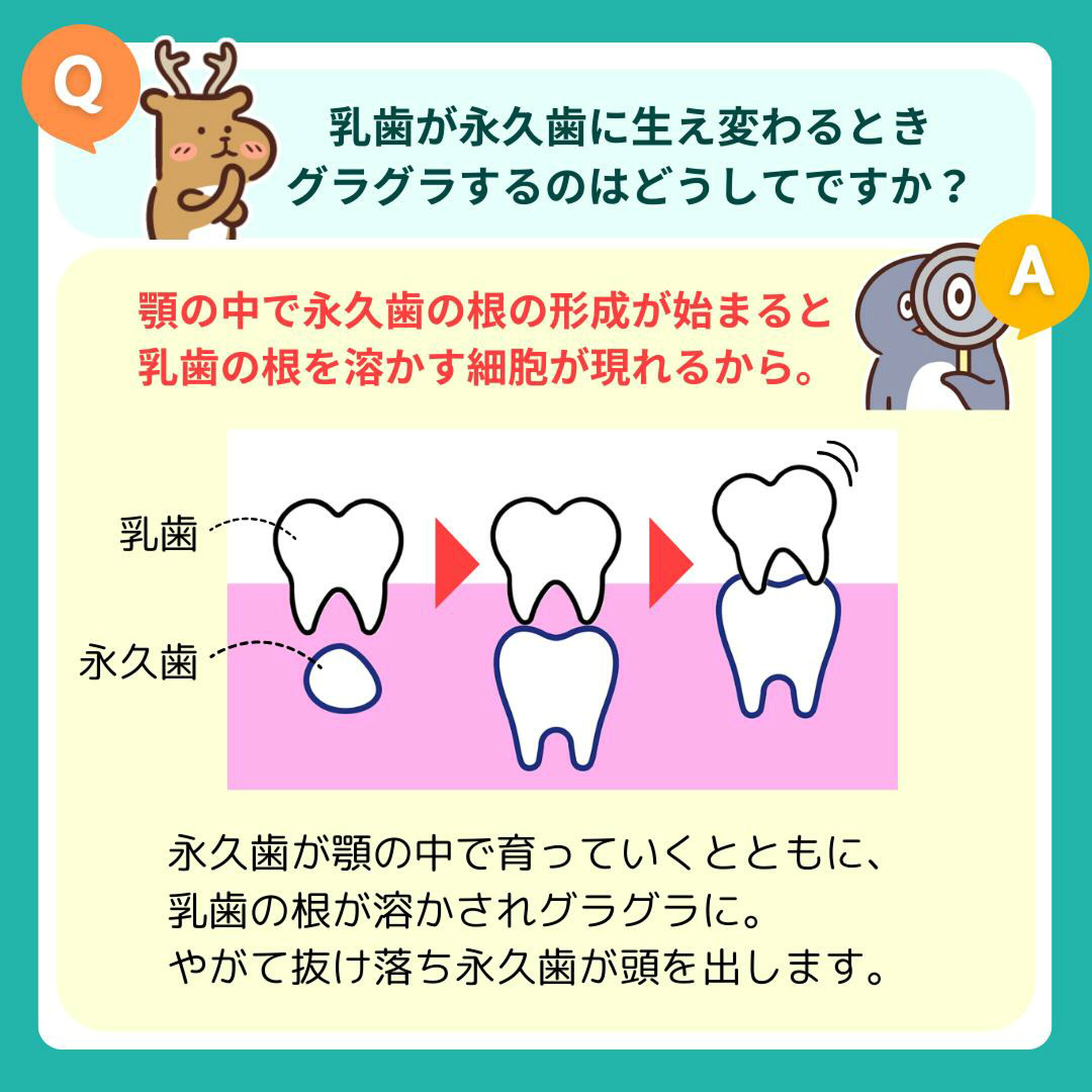 乳歯が永久歯に生え変わるときグラグラするのはどうしてですか？A.顎の中で永久歯の根の形成が始まると乳歯の根を溶かす細胞が現れるから。永久歯が顎の中で育つとともに、乳歯の根が溶かされグラグラに。やがて抜け落ちて永久歯が頭を出します。