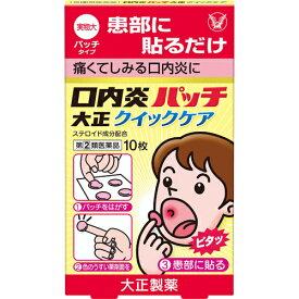 口内炎　パッチ 大正クイックケア 10枚 ※税控除対象商品　外用薬　　　医薬品　医薬部外品　　【あす楽対応】