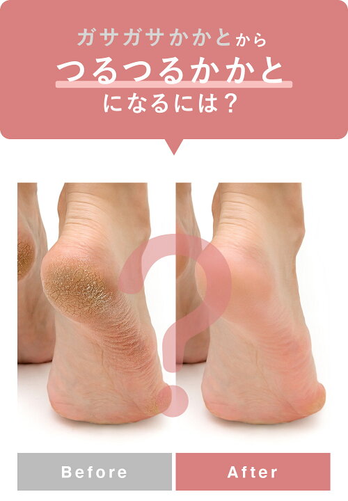 楽天市場 楽天1位10冠達成 Silkto シルクト かかとケア 保湿 ソックス 軽石 セット 日本製 シルク 絹 シルクプロテイン シルクパウダー かかと美容サポーター 保湿シート かかと美人 かかと 角質 ひび割れ かさかさ 靴下 素足 サンダル レディース One Up