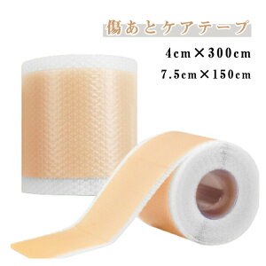 �����ƃP�A�e�[�v �鉤�؊J ���ՃP�A �V���R���W�F���V�[�g �L�W�h���}�� ���C�y�� ���O���\�h �ی�e�[�v 4cm×150cm 4cm×300cm 7.5cm×150cm