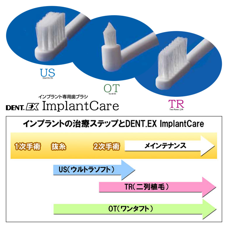 全国組立設置無料 インプラントのセルフケアに最適 1本 ライオン DENT EX インプラントケア ImplantCare