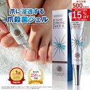 指定医薬部外品 爪周り消毒ジェル 薬用 クリーム 足爪 爪悩み 殺菌 細菌 消毒 爪周りケア『クリアストロングショット …