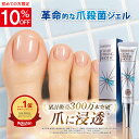 指定医薬部外品 爪周り消毒ジェル 薬用 クリーム 足爪 爪悩み 殺菌 細菌 消毒 爪周りケア『クリアストロングショット …