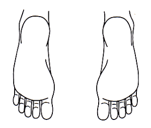 シャチハタ角型印　医療用人体図　足の裏20×30mm