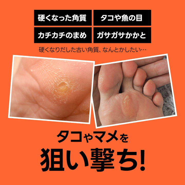 楽天市場 かかと 削り 角質除去ガンコな魚の目や角質に スクラッチ フットケア イボ削り 角質 角質取り 足 たこ 除去 角質削り かかと 足裏 手 魚の目 削り カッター うおのめ削り うおの目 ウオノメ うおのめ タコ たこ取り タコ取り メール便a お手軽美人