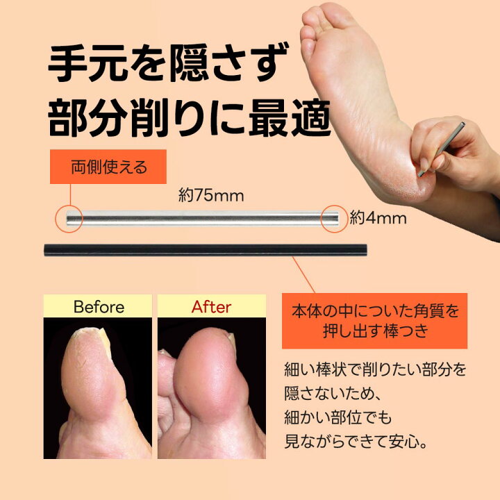楽天市場 かかと 削り 角質除去ガンコな魚の目や角質に スクラッチ フットケア イボ削り 角質 角質取り 足 たこ 除去 角質削り かかと 足裏 手 魚の目 削り カッター うおのめ削り うおの目 ウオノメ うおのめ タコ たこ取り タコ取り お手軽美人