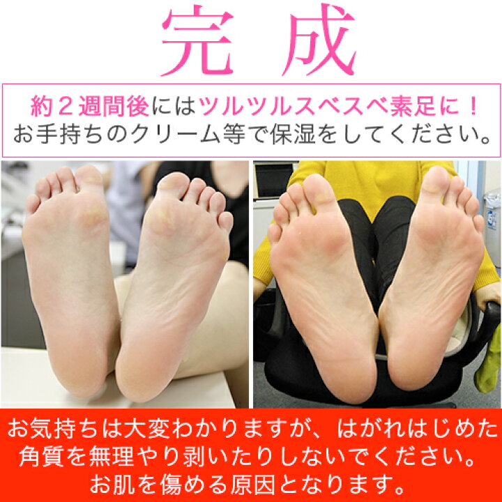 セットで買ってお得 1 000円 パック Care 足 ミジン フット ピーリング ミラクル ソフト ポッキリ Mj Mijin