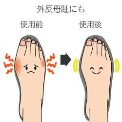 楽天市場 2個組 収納袋付き靴幅ひろげ る レディース メンズ 靴 くつ クツ 調整 靴ずれ 横幅 きつい靴 履けない靴 パンプス ヒール ハイヒール オックスフォード おじ靴 革靴 ブーツ ビジネスシューズ 外反母趾 メール便 Real Style リアルスタイル