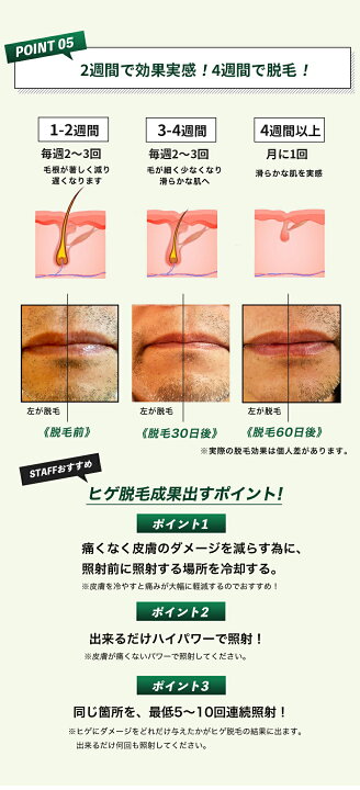 円 安い購入 プロ仕様モデル メンズ 髭 脱毛器 冷却ダイヤモンドサファイヤ Ulike ひげ脱毛 家庭用 光脱毛器 脱毛機 青ヒゲ ワキ 腕 胸 足 男性用脱毛 ムダ毛処理 男性 ヒゲ脱毛器 ヒゲ脱毛 ヒゲ脱毛機 痛くない脱毛機 Ipl