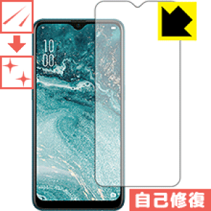 LYȏCیtB OPPO AX7 (Oʂ̂) { А