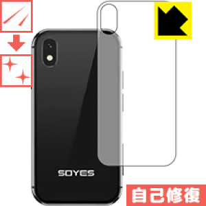 �L�Y���ȏC���ی�t�B���� Soyes XS (�w�ʂ̂�) ���{�� ���А�������