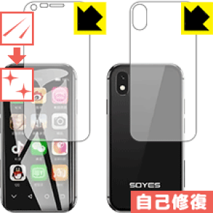 �L�Y���ȏC���ی�t�B���� Soyes XS (���ʃZ�b�g) ���{�� ���А�������