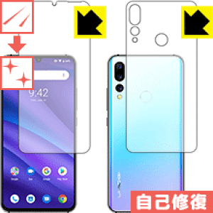 LYȏCیtB UMIDIGI A5 Pro (ʃZbg) { А