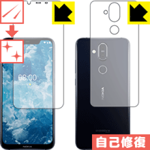 �L�Y���ȏC���ی�t�B���� Nokia 8.1 (���ʃZ�b�g) ���{�� ���А�������