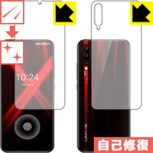 LYȏCیtB UMIDIGI X (ʃZbg)y wFؑΉ z { А