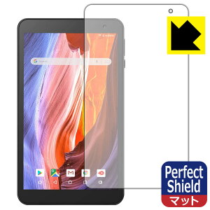 Perfect Shield VANKYO [L[ MatrixPad S7 { А