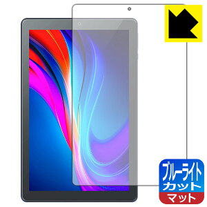 �u���[���C�g�J�b�g�y ���˒ጸ �z�ی�t�B���� VANKYO �����[�L���[ S21 ���{�� ���А�������