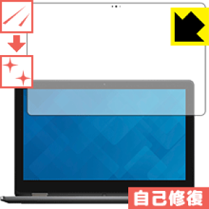 �L�Y���ȏC���ی�t�B���� Inspiron 15 7000�V���[�Y 2-in-1(7568) ���{�� ���А�������