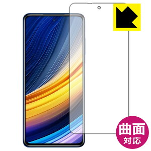 Flexible Shield�y ���� �z�ی�t�B���� Xiaomi POCO X3 Pro (�O�ʂ̂�) ���{�� ���А�������