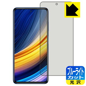 u[CgJbgy  zیtB Xiaomi POCO X3 Pro { А