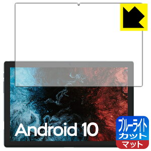 �u���[���C�g�J�b�g�y ���˒ጸ �z�ی�t�B���� VASTKING KingPad K10 / K10 Pro ���{�� ���А�������