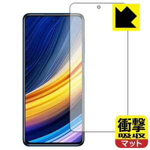 �Ռ��z���y ���˒ጸ �z�ی�t�B���� Xiaomi POCO X3 Pro ���{�� ���А�������