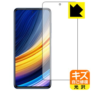 �L�Y���ȏC���ی�t�B���� Xiaomi POCO X3 Pro ���{�� ���А�������