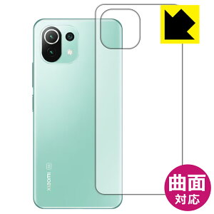 Flexible Shieldy  zیtB Xiaomi Mi 11 Lite 5G (wʂ̂) { А