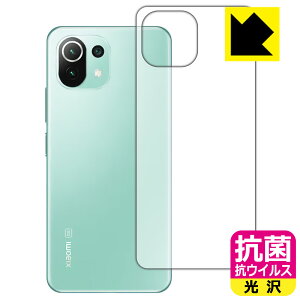 R RECXy  zیtB Xiaomi Mi 11 Lite 5G (wʂ̂) { А