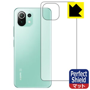 Perfect Shield Xiaomi Mi 11 Lite 5G (wʂ̂) 3Zbg { А