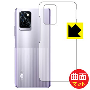 Flexible Shield Mattey ˒ጸ zیtB Infinix NOTE 10 Pro (wʂ̂) { А