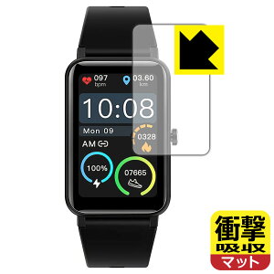 �Ռ��z���y ���˒ጸ �z�ی�t�B���� STSEETOP �X�}�[�g�E�H�b�` TRU-01 / ZX18 ���{�� ���А�������
